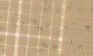 Read more about the article Infection in Semen